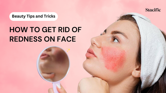 how-to-get-rid-of-redness-on-face